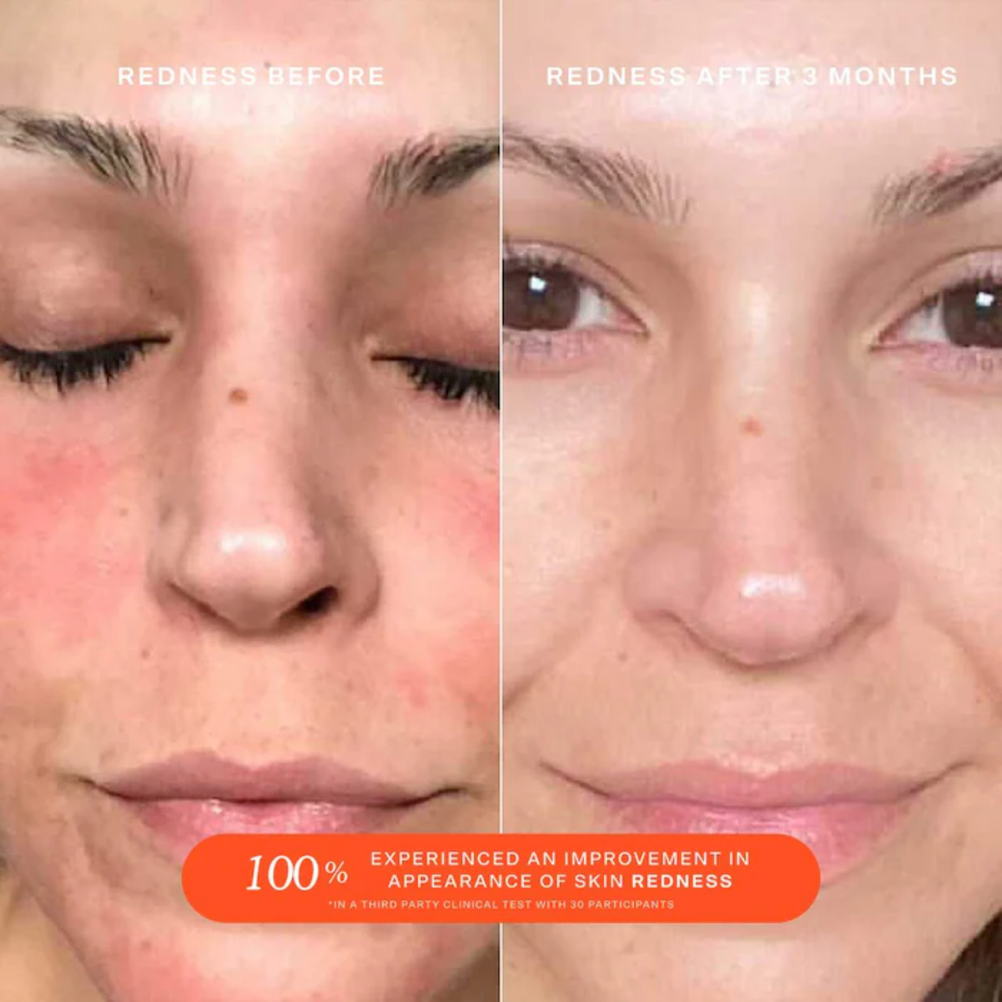 SOS Daily Rescue Facial Spray
