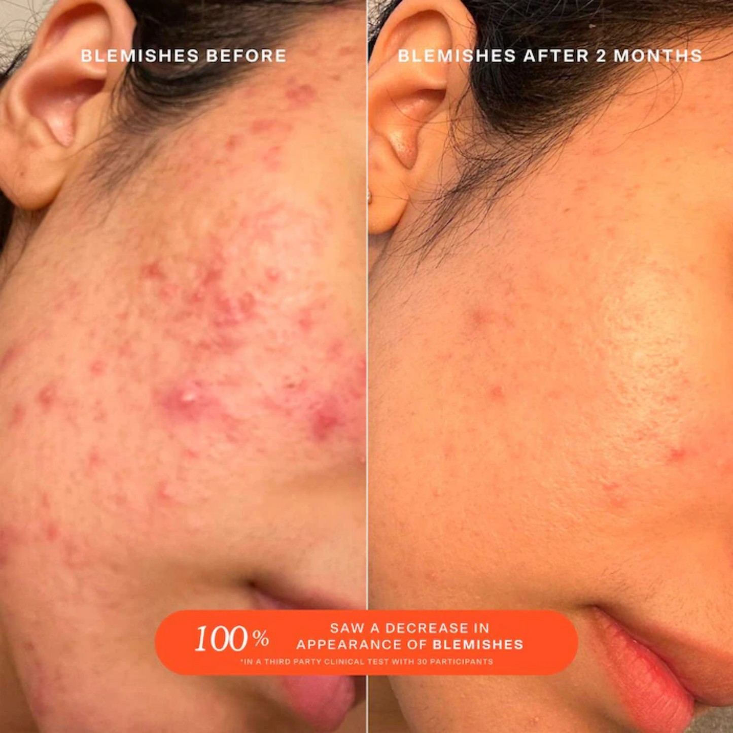 SOS Daily Rescue Facial Spray